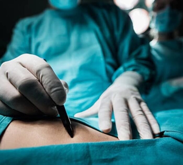 Comisión del Senado aprueba dictamen para limitar cirugías estéticas en menores