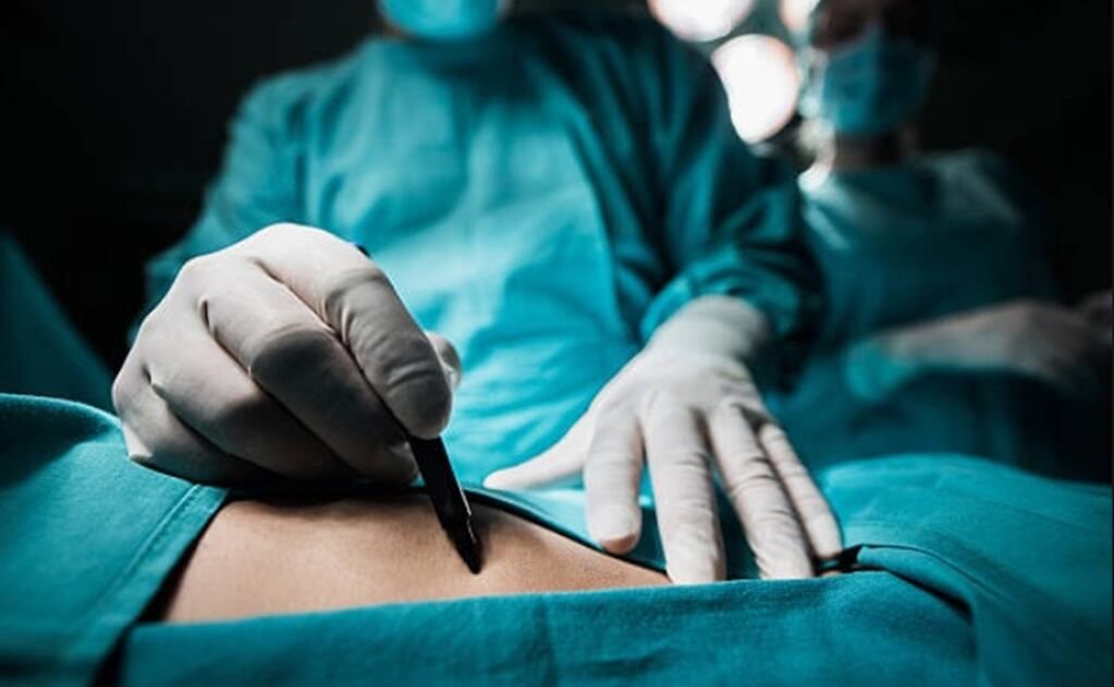 comision-del-senado-aprueba-dictamen-para-limitar-cirugias-esteticas-en-menores